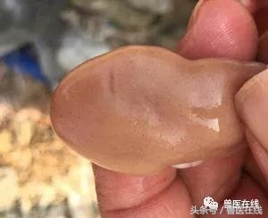 过量补硒对肝脏的危害(补硒对肝)-硒宝网