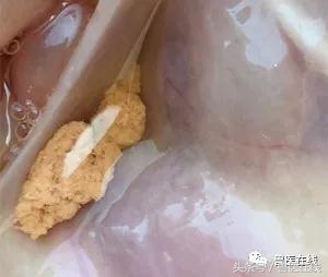 过量补硒对肝脏的危害(补硒对肝)-硒宝网