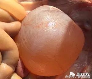 过量补硒对肝脏的危害(补硒对肝)-硒宝网