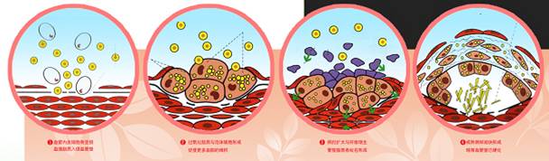 血管有斑块补硒有用吗（有血管补斑块硒用量多少）-硒宝网