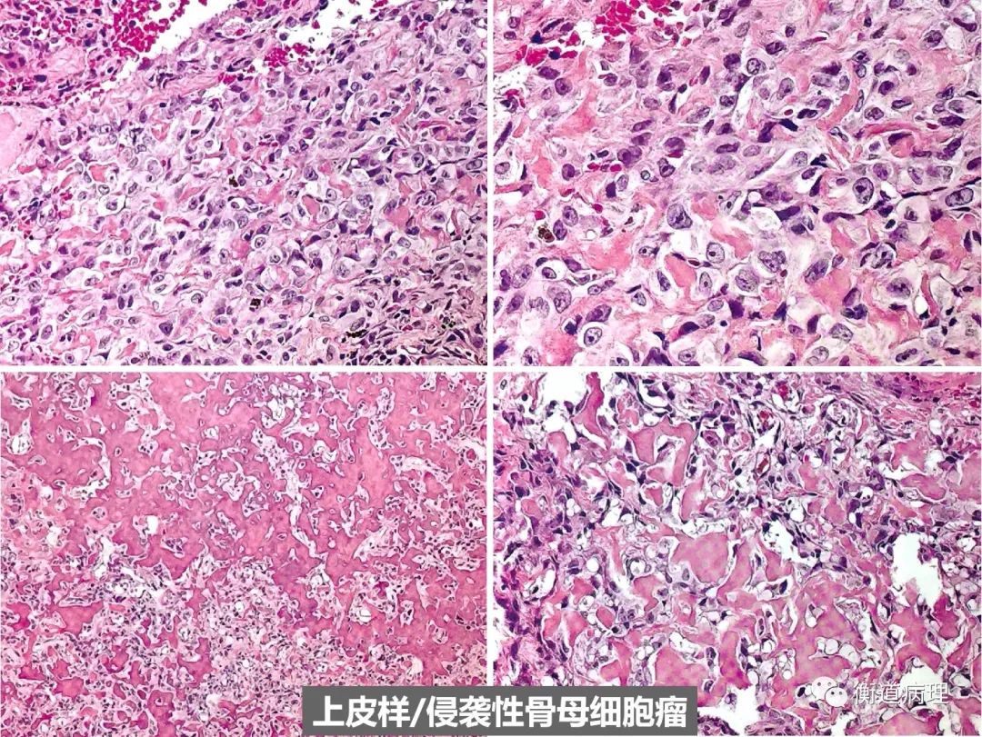 补硒会导致口腔溃疡嘛（口腔溃疡和缺硒有关吗）-硒宝网