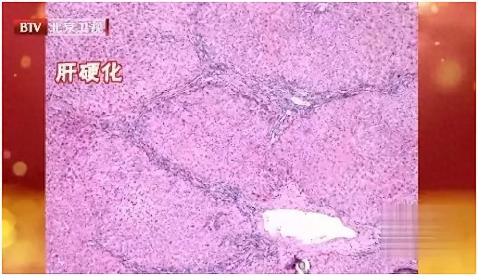 补硒会造成口腔溃疡吗(口腔溃疡补硒有效果吗)-硒宝网