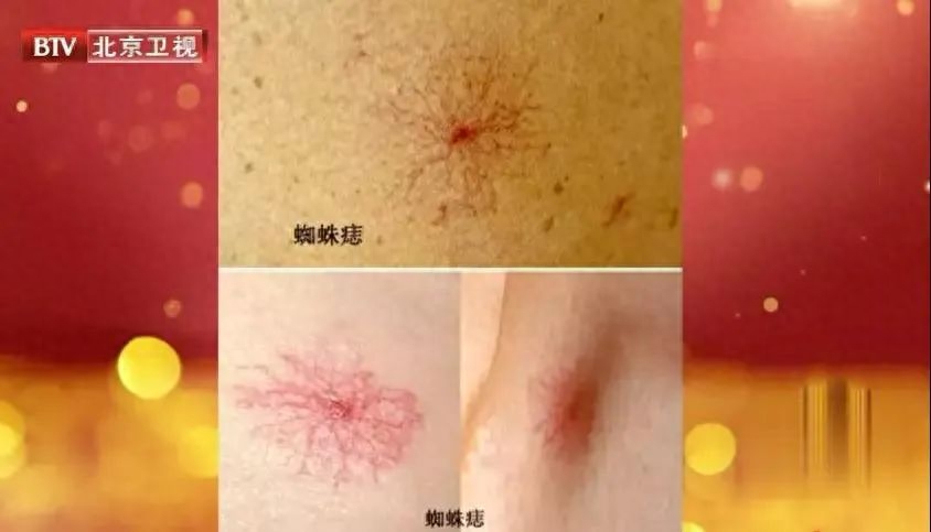 补硒会造成口腔溃疡吗(口腔溃疡补硒有效果吗)-硒宝网