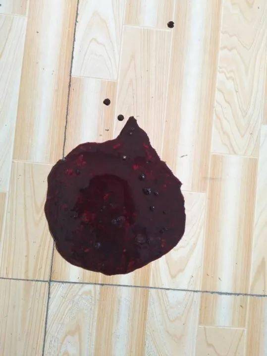 胃溃疡怎么补硒好的快(胃溃疡吃补品)-硒宝网