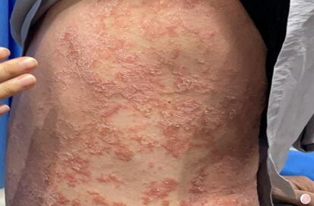 什么是锌硒宝(锌硒宝是干嘛的)-硒宝网