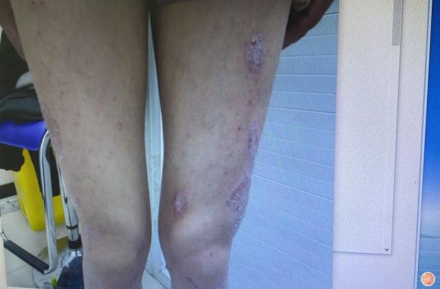 什么是锌硒宝(锌硒宝是干嘛的)-硒宝网