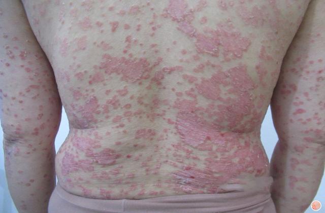 什么是锌硒宝(锌硒宝是干嘛的)-硒宝网