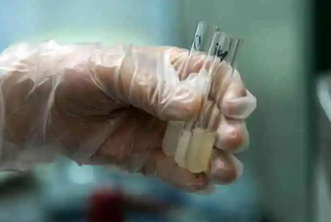 孕妇如何补硒（孕妇补硒的好处）-硒宝网