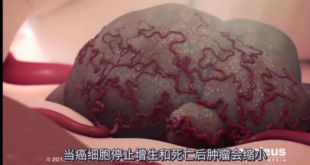 化疗后 补硒（化疗吃硒片）-硒宝网