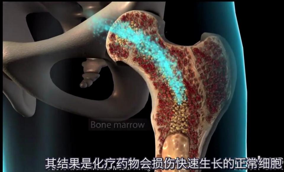 化疗后 补硒（化疗吃硒片）-硒宝网