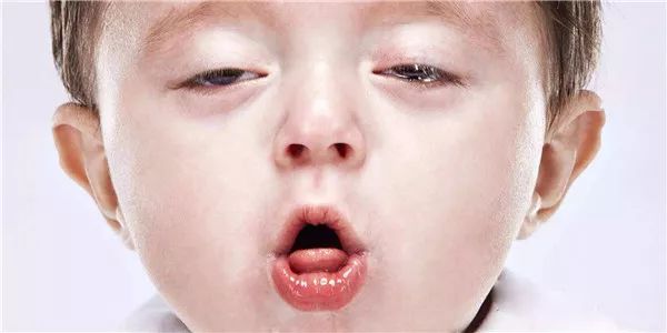 过敏体质补硒(硒对过敏体质有什么作用)-硒宝网