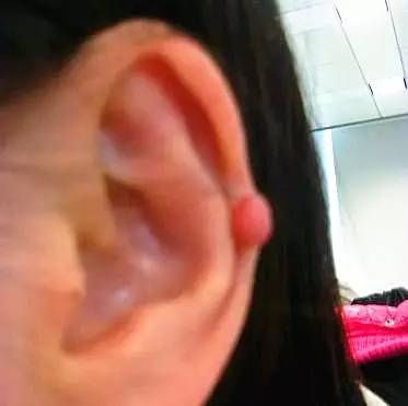 补硒降低血沉（补降低硒血沉的中药）-硒宝网