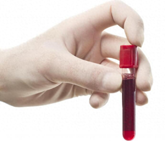 哪些药物补硒(药物补硒好吗)-硒宝网