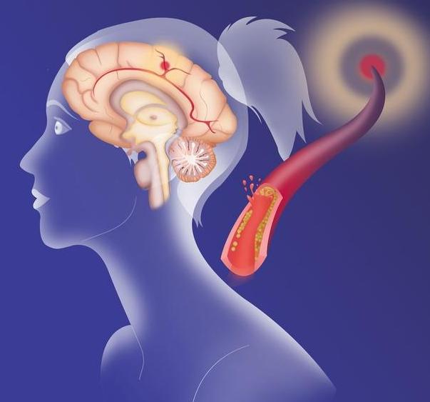 补硒会头疼吗(补硒会头疼吗)-硒宝网