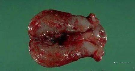 经期补硒止血(止血经期补硒的方法)-硒宝网