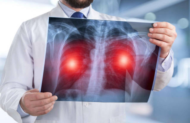 补硒防止斑点(补硒能淡化色斑吗)-硒宝网