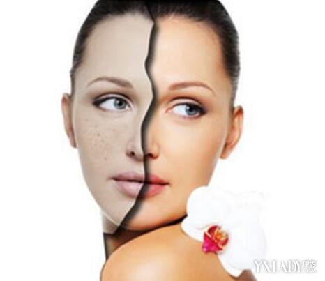 补硒对白癜风（补硒能治疗乙肝吗）-硒宝网