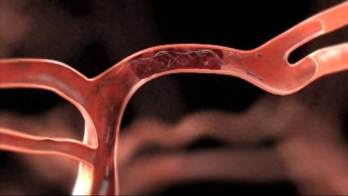 补硒抵御化疗(化疗补硒有什么作用)-硒宝网