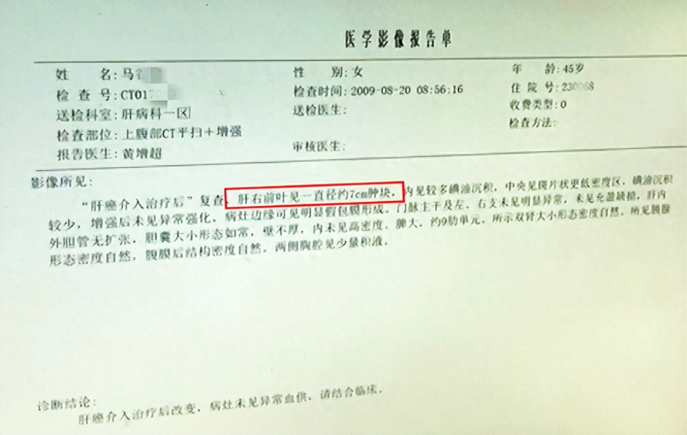 肝癌补硒好吗（得了肝癌补硒管用吗）-硒宝网