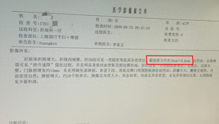 肝癌补硒好吗（得了肝癌补硒管用吗）-硒宝网