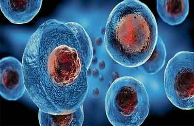 肠癌如何补硒(肠癌病人可以吃硒酵母吗)-硒宝网