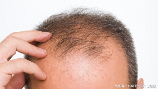 脱发补哪种硒(脱发补硒)-硒宝网