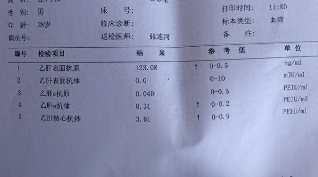 乙肝补硒产品（乙肝补硒产品哪个好）-硒宝网