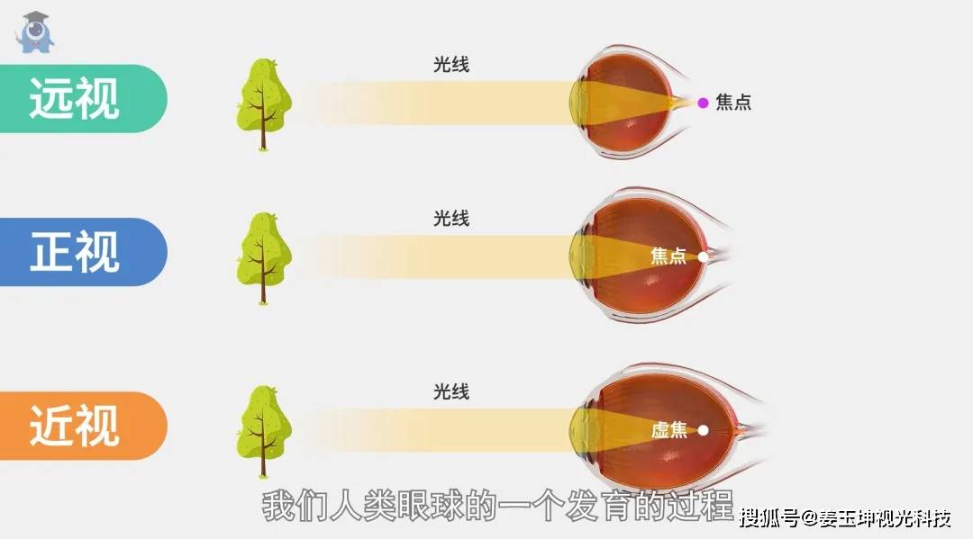 儿童散光补硒（补儿童散光硒有用吗）-硒宝网