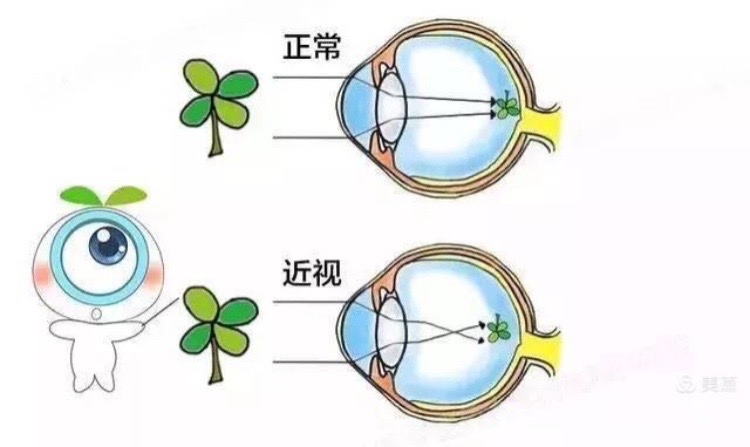 儿童散光补硒（补儿童散光硒有用吗）-硒宝网