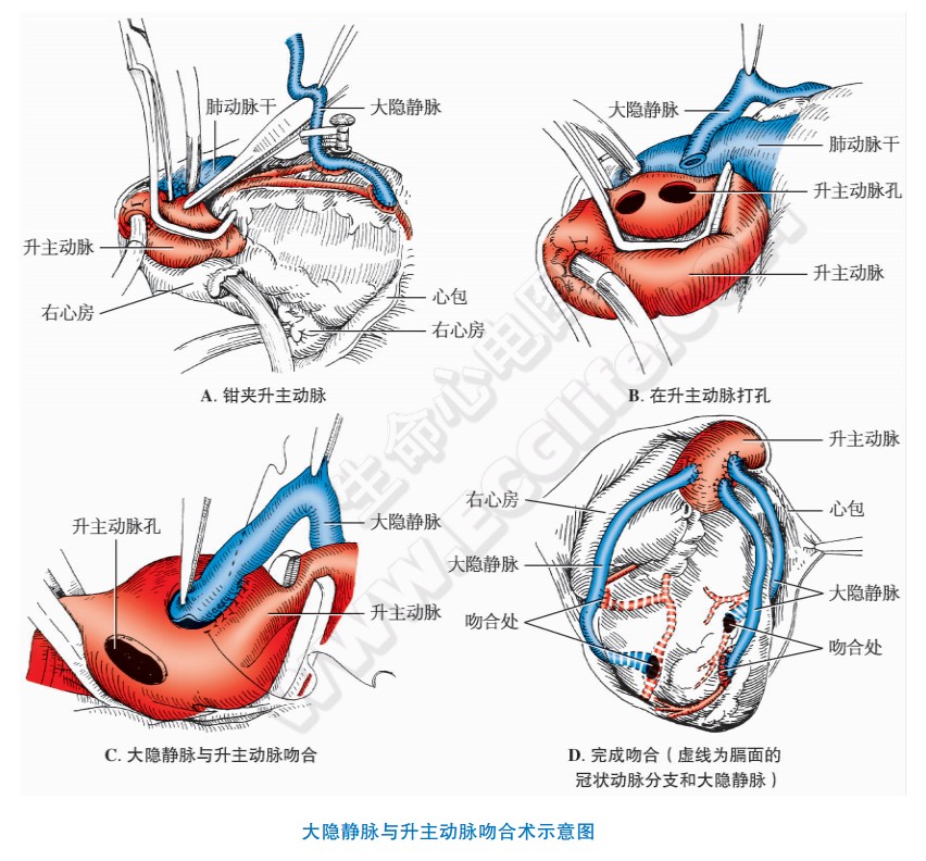 内膜息肉补硒(补内膜息肉硒片有用吗)-硒宝网
