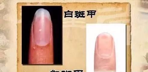 指甲发白补硒（指甲白要补充什么东西）-硒宝网