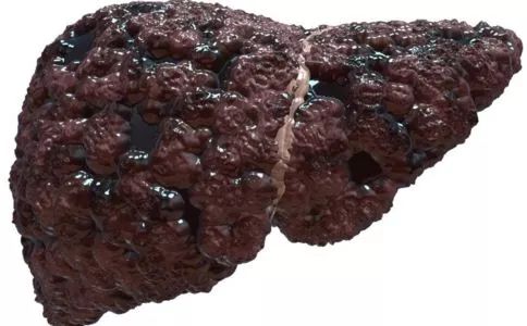 肝癌早期补硒(肝癌早期补硒)-硒宝网