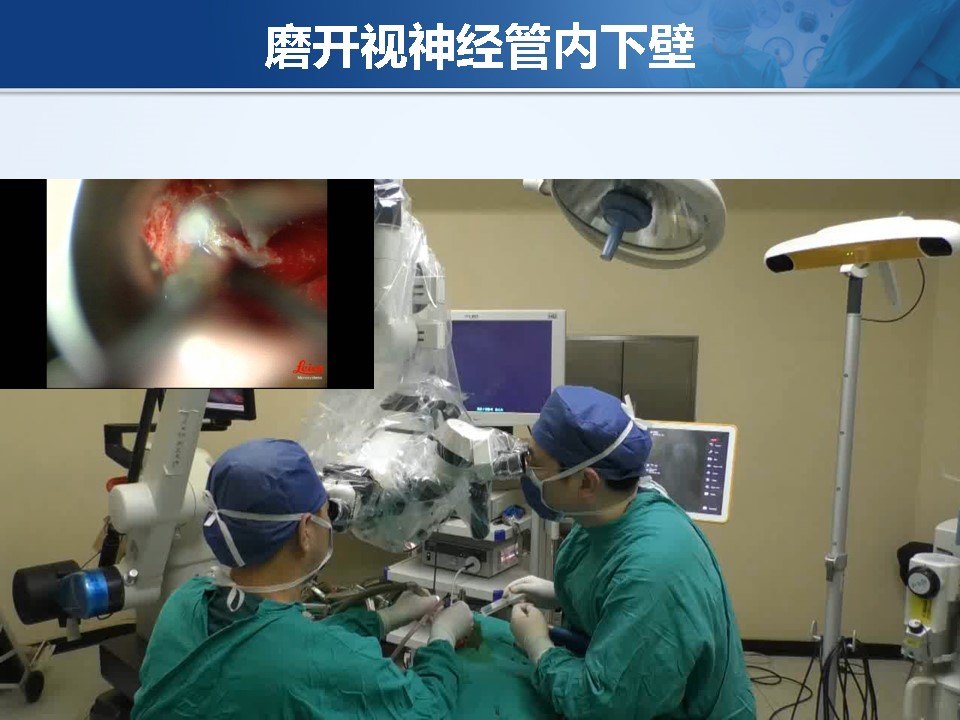 孕妇补硒方法(孕妇如何补硒)-硒宝网