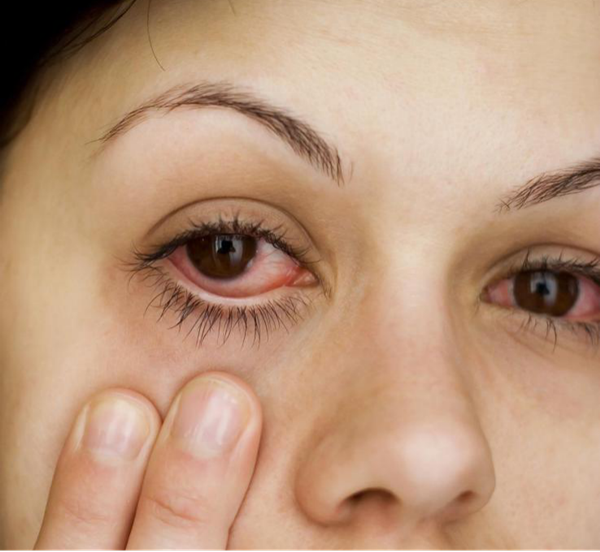 补硒眼睛充血(眼睛充血补硒有效果吗)-硒宝网