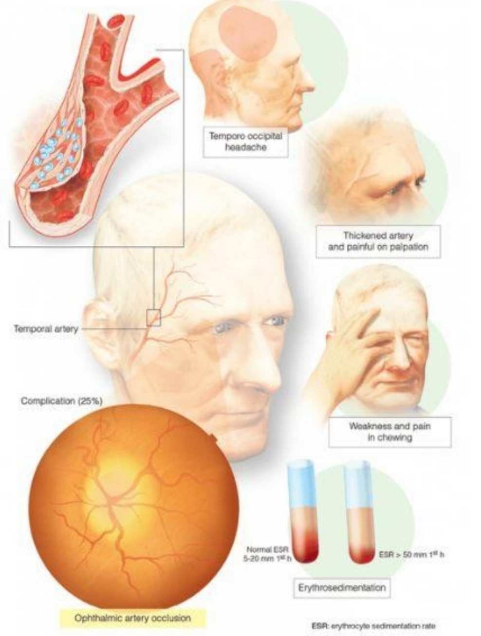 补硒正常反应(补硒后身体有哪些反应)-硒宝网