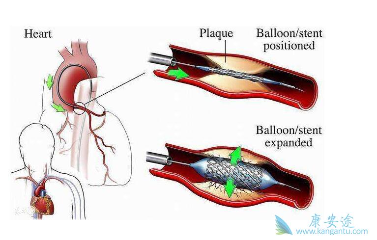 过度补硒后果（过度补硒后果）-硒宝网
