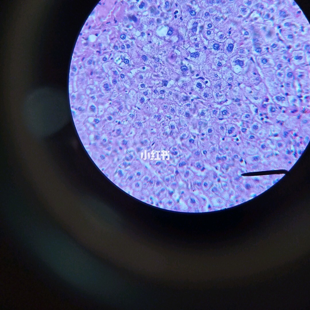 仔猪补硒过敏(仔猪补硒用什么药)-硒宝网