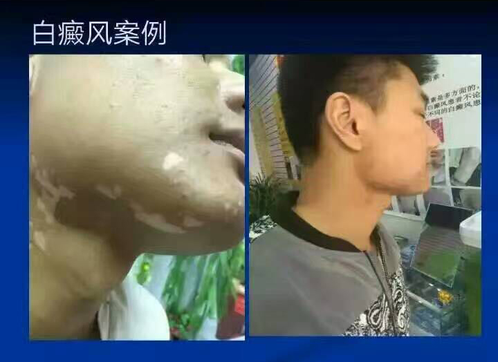 全球最好补硒(最好的补硒产品硒价格)-硒宝网