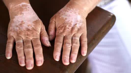 全球最好补硒(最好的补硒产品硒价格)-硒宝网