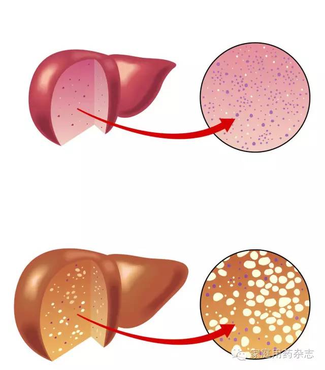 补硒引起过敏（补硒会过敏吗）-硒宝网