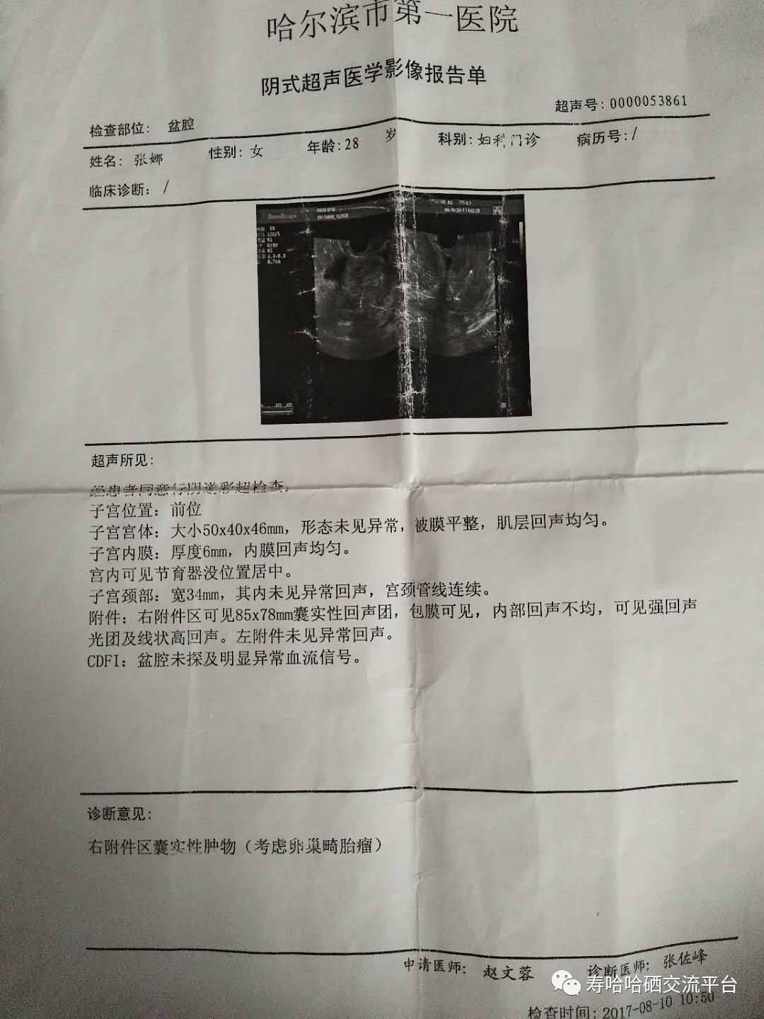 心脏补硒案例(补硒心脏)-硒宝网