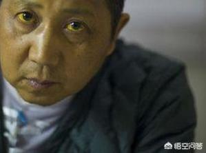 补硒皮肤变黄(补变皮肤黄硒素有用吗)-硒宝网