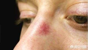 补硒皮肤变黄(补变皮肤黄硒素有用吗)-硒宝网