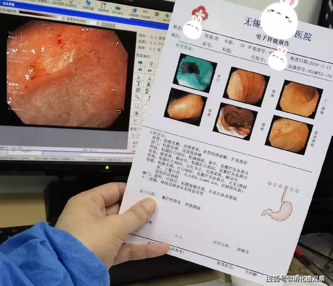 补硒会口臭吗(吃硒容易得口腔溃疡吗)-硒宝网