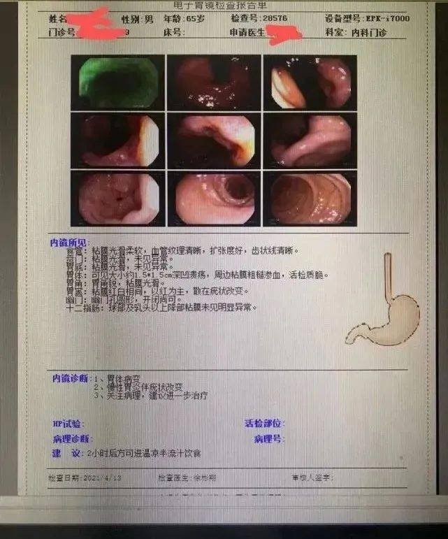 补硒会口臭吗(吃硒容易得口腔溃疡吗)-硒宝网