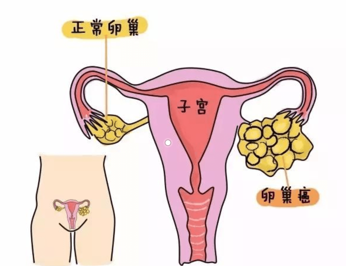 多囊可以补硒（多囊可以补硒）-硒宝网