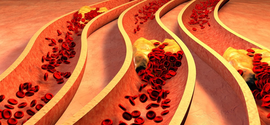 血脂稠能补硒（血脂稠能补硒）-硒宝网