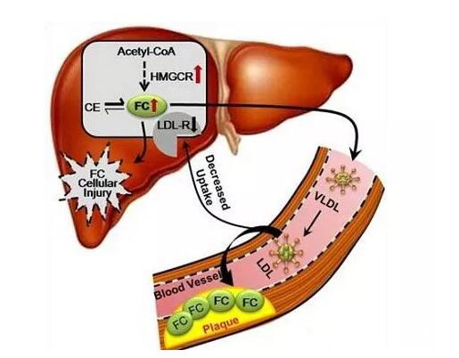 动脉硬化补硒（硬化动脉补硒有用吗）-硒宝网