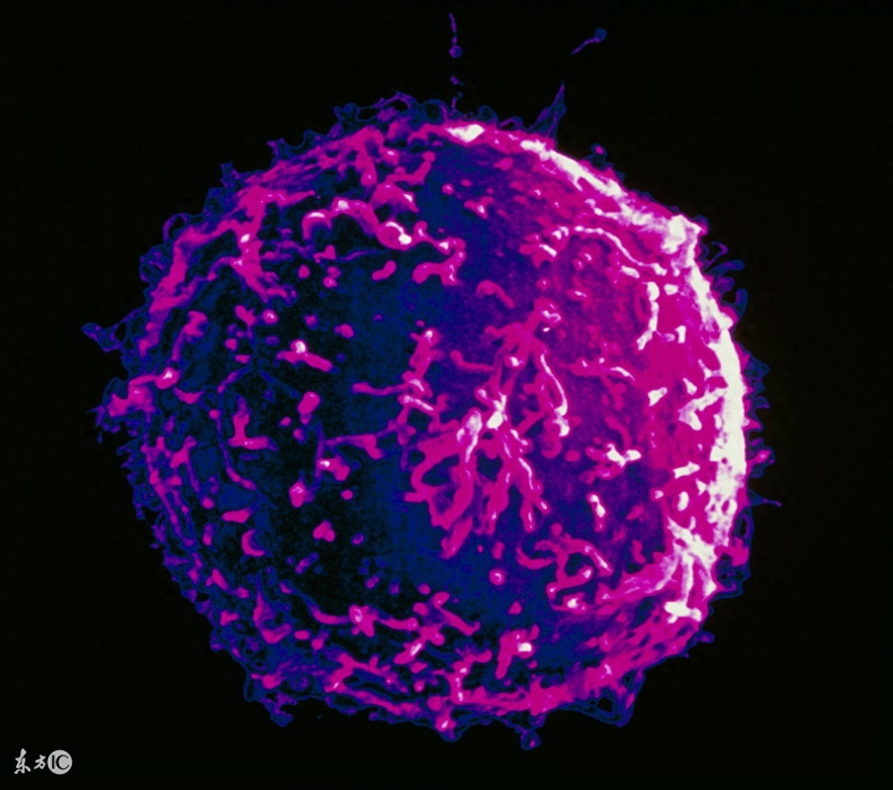 恶性肿瘤补硒(肿瘤恶性补硒能治好吗)-硒宝网