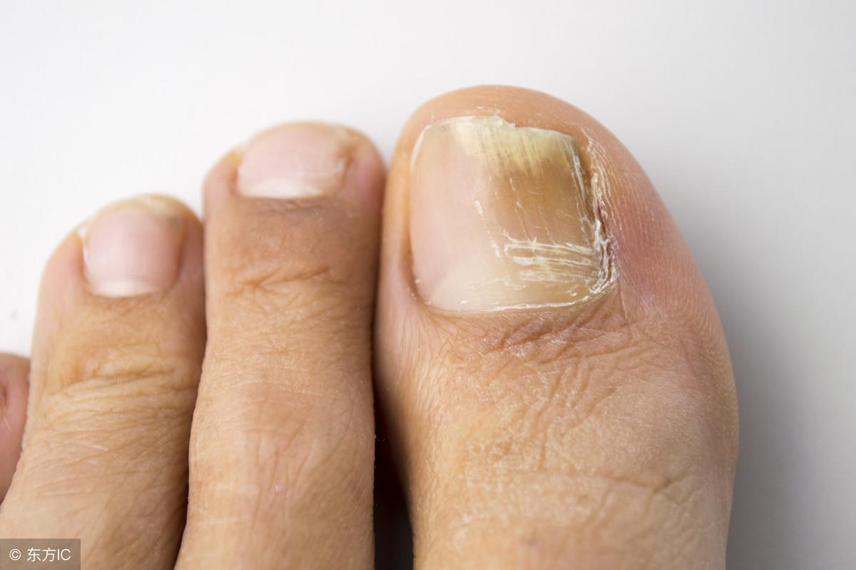 补硒治脚痛吗(补硒治疗)-硒宝网